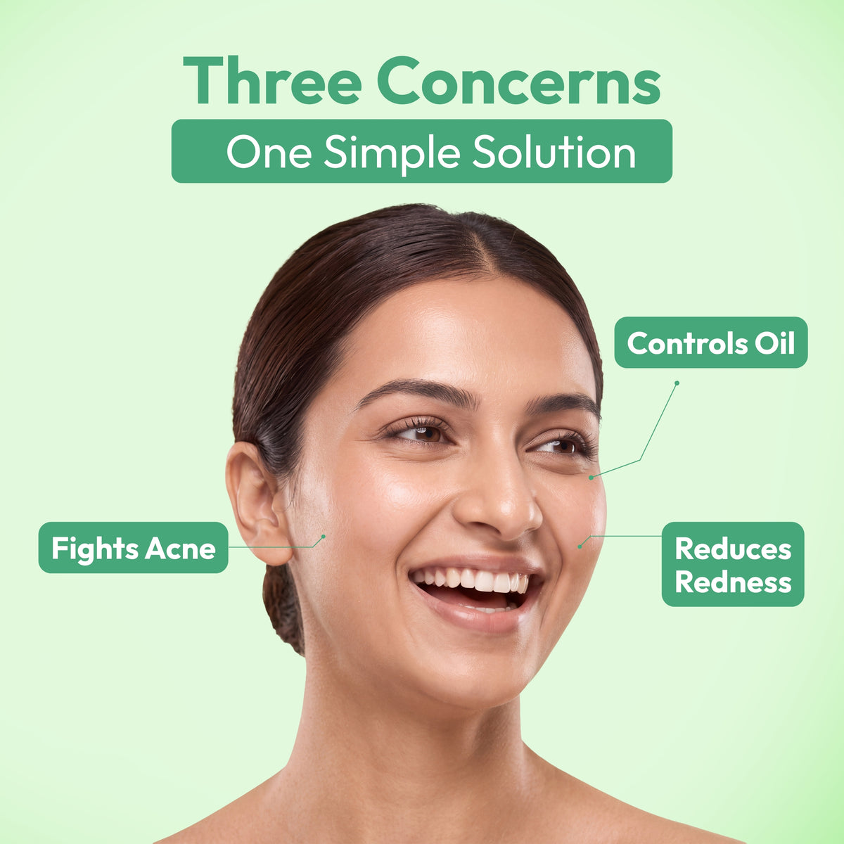 Anti-Acne Serum – 30ml  Fights Acne, Controls Oil, Calms Redness